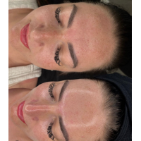 LACTIC BRIGHTENING PEEL 40%, pH 2,9. Всесезонный молочный пилинг для чувствительной кожи, 50 мл