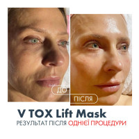 V TOX LIFT MASK. Ультраактивная маска для безинъекционного нитевого лифтинга с 11-ю Пептидами и 6-ю видами Коллагена. Инновационная жидкая формула с трансформацией на коже: высыхание, глянцевый каркас, сильное лифтинговое натяжение, 100 мл