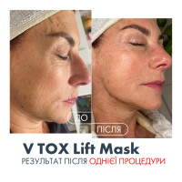 V TOX LIFT MASK. Ультраактивная маска для безинъекционного нитевого лифтинга с 11-ю Пептидами и 6-ю видами Коллагена. Инновационная жидкая формула с трансформацией на коже: высыхание, глянцевый каркас, сильное лифтинговое натяжение, 100 мл