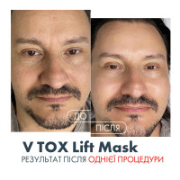 V TOX LIFT MASK. Ультраактивная маска для безинъекционного нитевого лифтинга с 11-ю Пептидами и 6-ю видами Коллагена. Инновационная жидкая формула с трансформацией на коже: высыхание, глянцевый каркас, сильное лифтинговое натяжение, 100 мл